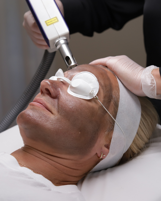 Carbon Facial
