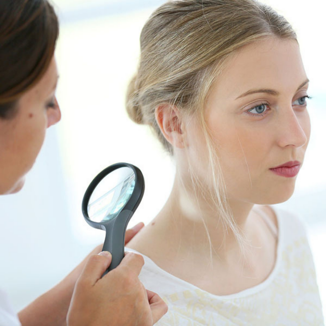 Skin Cancer Consultation and Assesment